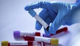 KKTC'de ve Kıbrıs Rum kesiminde en yüksek günlük Kovid-19 vaka sayıları kaydedildi