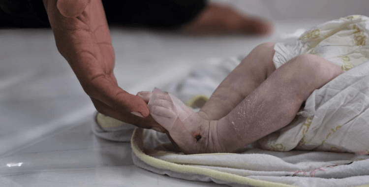 Açlıktan bebeğini kaybeden baba: Dünya Gazze'ye bir kutu mama gönderemiyorsa hepimiz öleceğiz