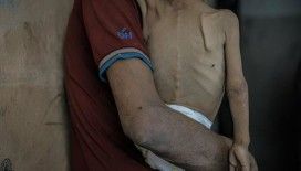 Gazze'de 127 Filistinli açlıktan hayatını kaybetti