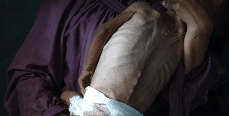 Gazze'de son 24 saatte 2'si çocuk 7 kişi daha açlıktan hayatını kaybetti