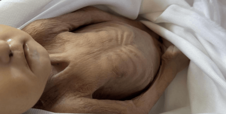 Gazze’de açlıktan ölenlerin sayısı 281’e yükseldi